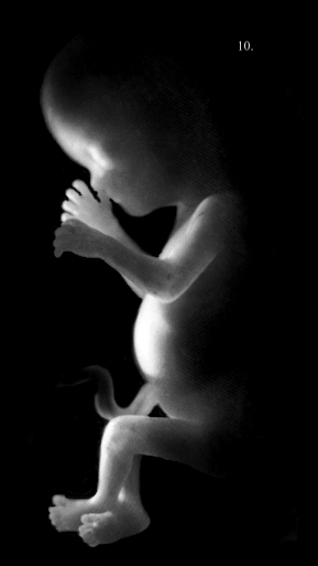 A 15 week old fetus.