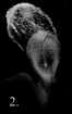 A 2 week old embryo.