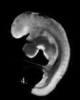An embryo just 4 weeks old.