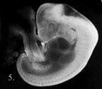 A 4 week old embryo.