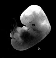 Embryo just under 5 weeks old.