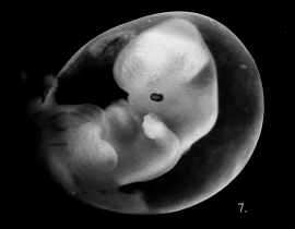 A 5 week old embryo.