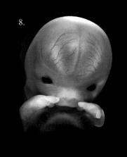 Portrait of a 7 week old embryo.