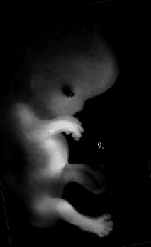 A 10 week old fetus.