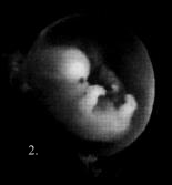 6 Week Old Embryo